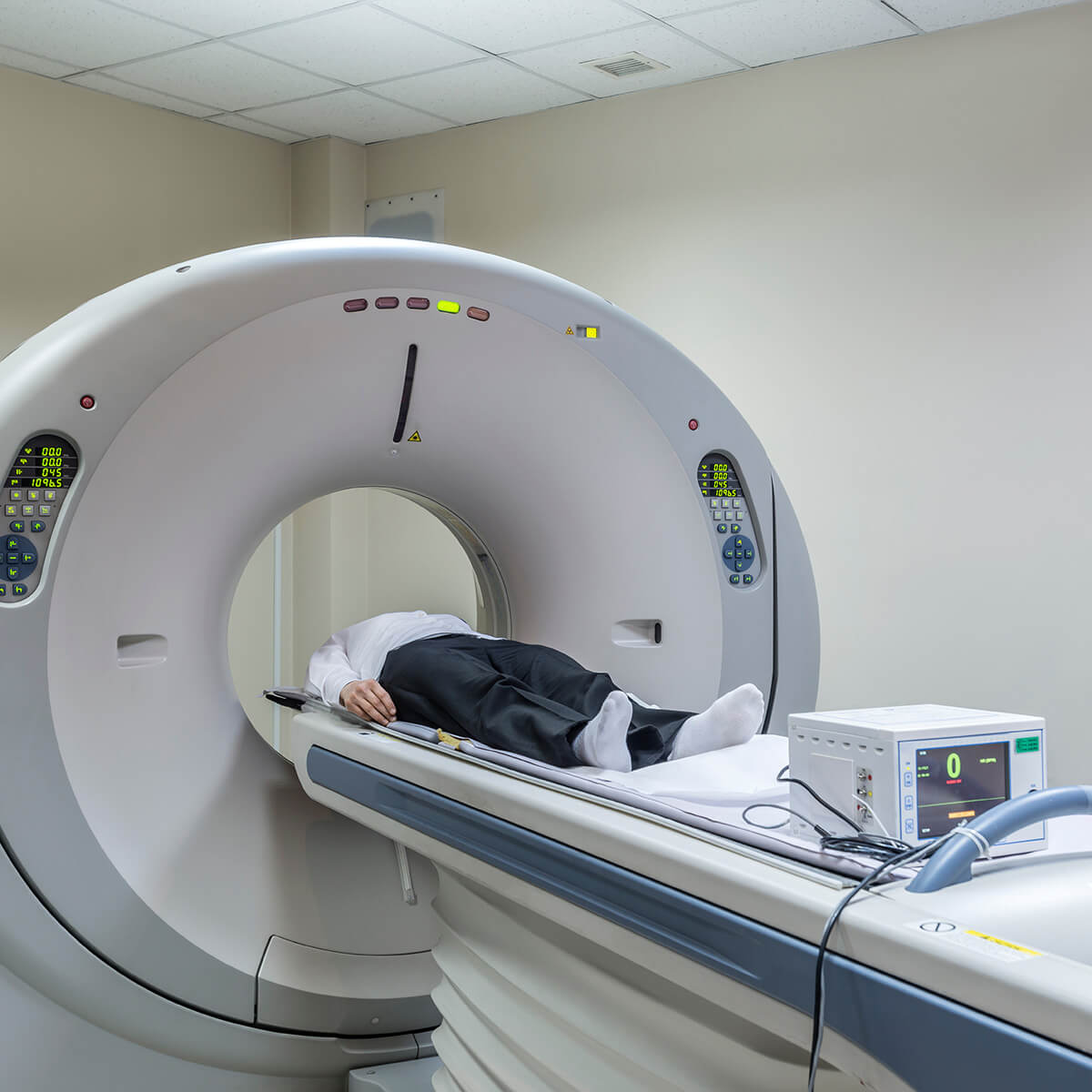 PET  to diagnose epilpsey